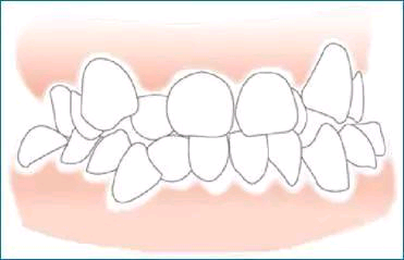 -ΪʲôҪʱ䣿