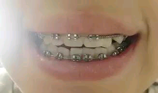 -ΪʲôҪʱ䣿